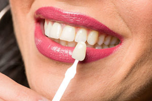 dental veneers tx, veneer being held up to woman's natural teeth