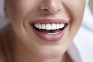 woman after teeth whitening