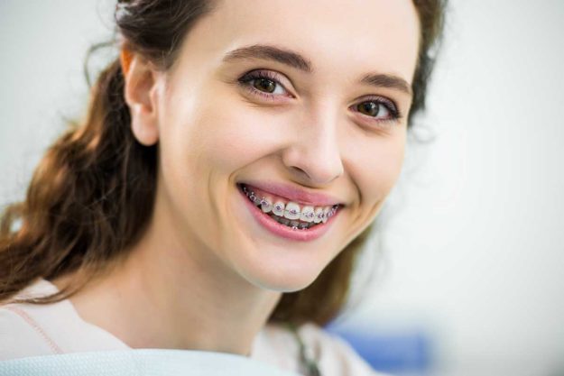 5-Signs-You-Need-Dental-Braces-Again (1) woman wearing dental braces
