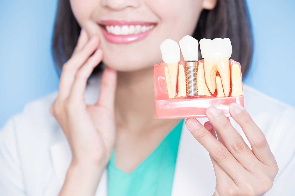 4-Benefits-of-Dental-Implants (1) example of a dental implant